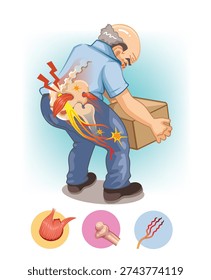 Illustration of lower back strain causing sciatic nerve pain while lifting a heavy object.