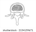 The illustration of lumbar vertebrae 
-The lumbar spine contains 5 vertebrae, labelled L1 to L5, which progressively increase in size going down the lower back. The vertebrae connected with joints.