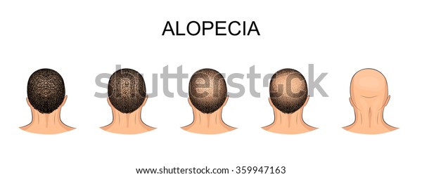 Strategies On How To Naturally Grow Your Hair (3)