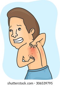 Illustration of a Man Desperately Scratching the Rashes on His Back