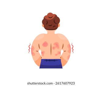 illustration of a man facing back. back full of red rashes. symptoms of skin disease, Atopic Dermatitis, eczema, Psoriasis, Fungal Infection. health problem. flat style character design. elements