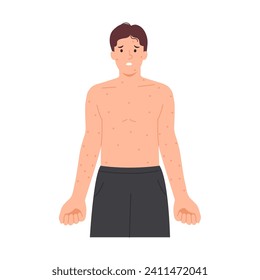 Illustration of a man with measles, red rash, itchy skin, skin disease concept. Flat design.