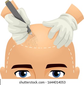 Illustration of a Man Receiving Hair Tattoo on the Head by a Pair of Hands Wearing Gloves and Using Pen Tattoo