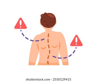 illustration of a man with scoliosis. spinal deformity, curved spine. posture. problems and health. flat style character design. elements