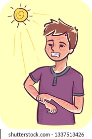 Illustration Of A Man Scratching His Red Skin. Photosensitivity