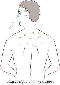 Illustration of a man with spots on her back
