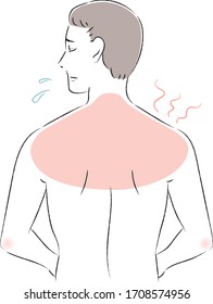 Illustration eines Mannes mit Sonnenbrand