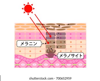 Illustration of the mechanism that can make spots, ultraviolet rays, melanin, melanocytes