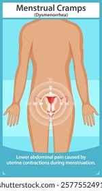 Illustration of menstrual cramps and uterine contractions