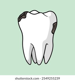 Ilustração da cavidade e cárie dentária molar