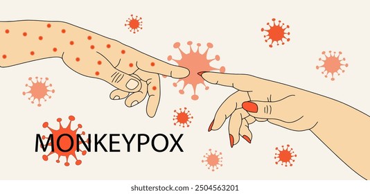 Illustration of monkeypox virus transmission.The hand of an infected person touches the hand of a healthy person. 