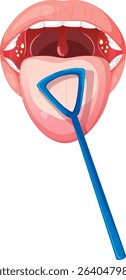Illustration of mouth with tongue scraper tool