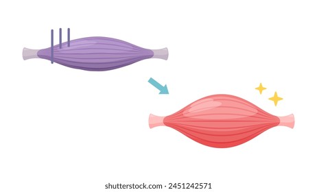 Illustration of muscles changing from unhealthy to healthy