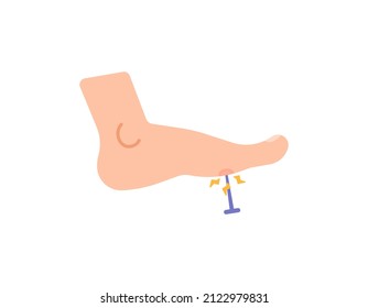 illustration of a nail pierced by a foot, stuck a nail in the leg. illness, incident, injury. flat cartoon. design elements. human body parts
