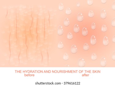 Illustration Nourish And Hydrate The Skin. Dry Skin Before And After Hydration