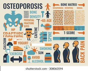 Illustration Of Osteoporosis Infographic Icon And Elements Concept