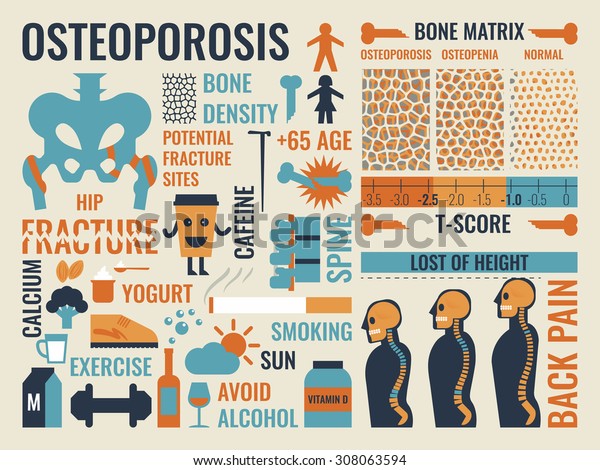 Illustration Osteoporosis Infographic Icon Elements Concept Stock