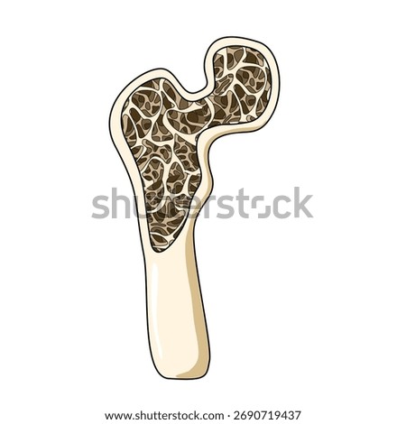 Illustration of osteoporosis, low bone density, Vector for medical, clinical, or educational posters.