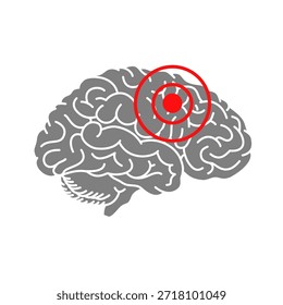 Ilustração da dor no cérebro humano. Adequado para elementos médicos vetoriais, cefaleias, locais de sangramento, derrames, câncer cerebral ou outros símbolos médicos