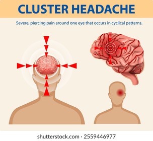 Illustration of pain patterns and brain anatomy