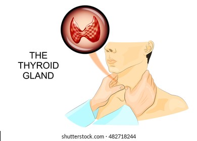 illustration of a palpation of the thyroid gland
