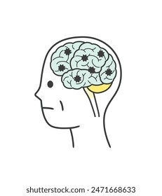 Illustration of parts of the brain damaged by Lewy body dementia