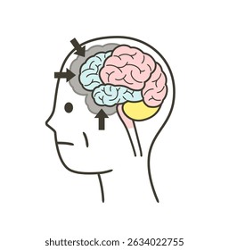 Illustration of parts of the brain damaged by frontotemporal dementia