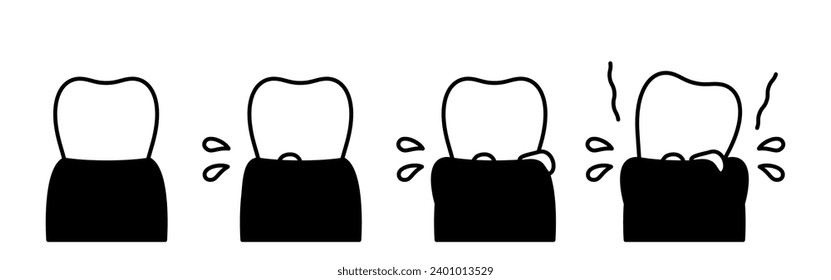 Illustration of periodontal disease progression image, simple line drawing, Vector Illustration