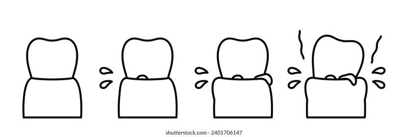 Illustration of periodontal disease progression image, simple line drawing, Vector Illustration