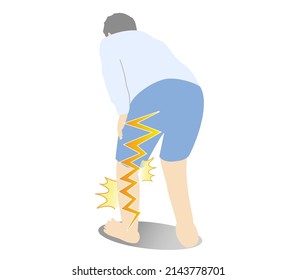 Illustration of a person suffering from sciatica