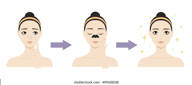 Illustration: Pretty Vector Woman With Comedo Using Anti-blackhead Nose Strip. Cute Cartoon Girl With Skin Problem Shows The Result Of Using Care Cosmetic Product. Icon Set For Skincare Infographic.