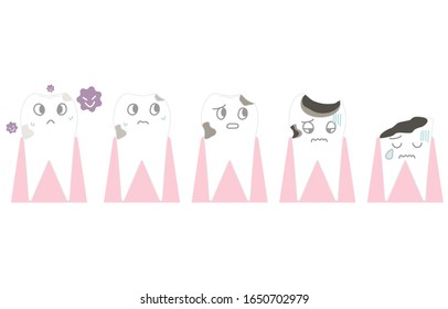 Illustration of progress of tooth decay