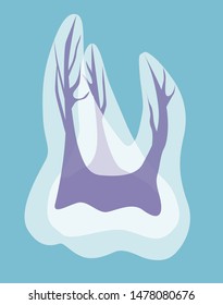 Illustration of pulp of maxillary molar