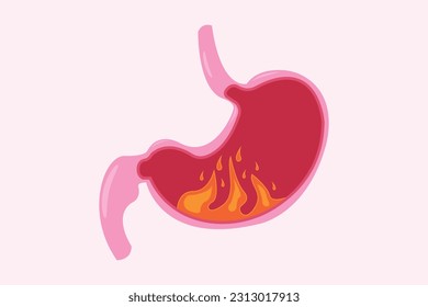 illustration of pyrosis stomach and nausea stomach. Pyrosis fire disorder, gastric acid reflux. Stomach medical illustration set