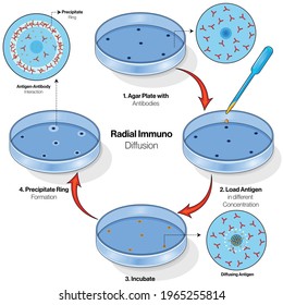 Illustration of Radial immunodiffusion Assay.