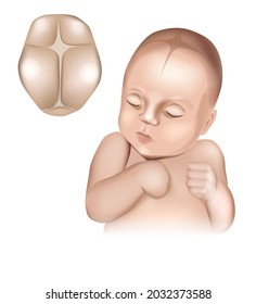 An illustration of a realistic babys head showing the fontanelles present at birth. Cranial sutures and fontanels.