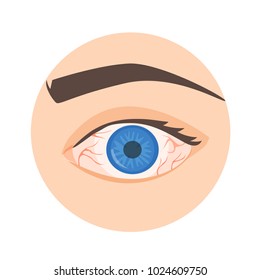 
Illustration Of A Red Eye. Disease. Infection.
