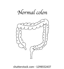 illustration represent the human intestine.