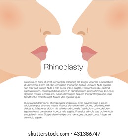 illustration of rhinoplasty. cosmetic surgery. aesthetic medicine. vector