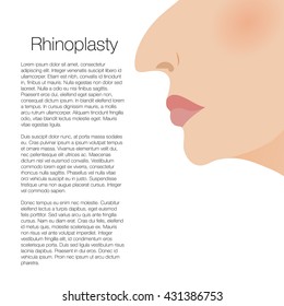 illustration of rhinoplasty. cosmetic surgery. aesthetic medicine. vector