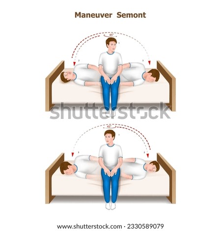illustration of the Semont maneuver, a practical guide to the treatment of positional paroxysmal vertigo. Tutorial step by step. Vector.