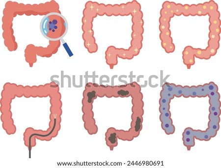 Illustration set of colon conditions