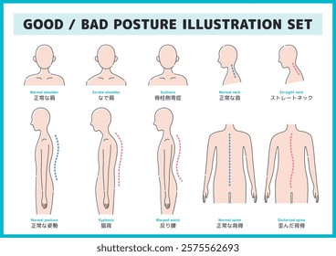 Illustration set of correct posture and hunchback