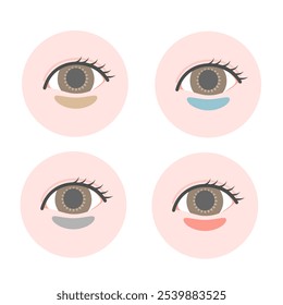 Conjunto de ilustrações de círculos escuros sob os olhos