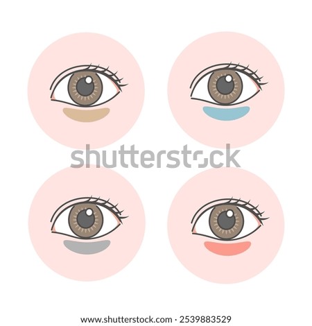 Illustration set of dark circles under the eyes