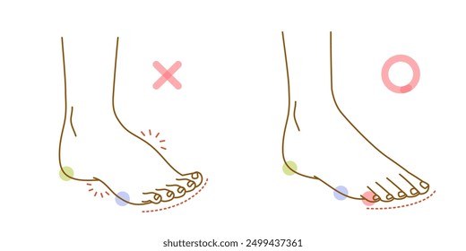 Illustration set of floating toes and normal soles