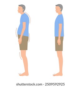 Ilustração conjunto de dedos flutuantes e solas normais dos pés de sênior (postura pobre de todo o corpo masculino)