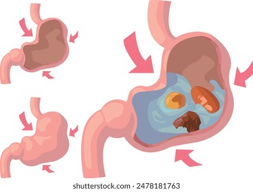 Illustration set of how food is digested in the stomach