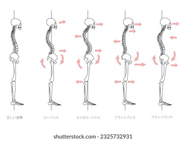 Illustration set of skeleton with poor posture seen from the side