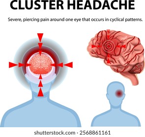 Illustration of severe headache and brain pain